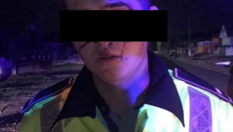 Polițist, bătut cu cătușele în cap de un copil de etnie romă