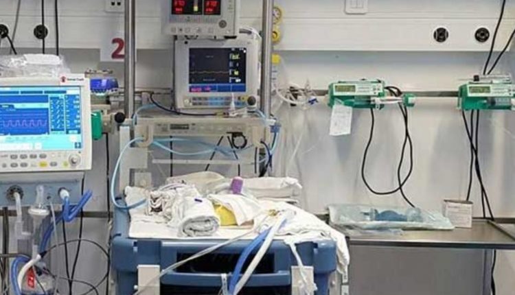 Cum este posibil ca Serbia să aibă mai multe aparate de respirat decât România?